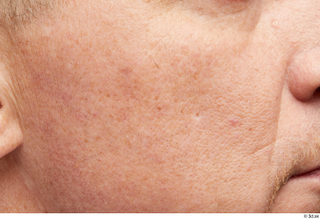 HD Face Skin Steve Q cheek face scar skin pores…